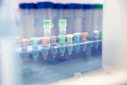 analysis in a laboratory