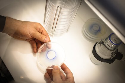 Two hands hold a Petri dish in which a finding is colored in a violet tone. There are more Petri dishes on a table next to it.