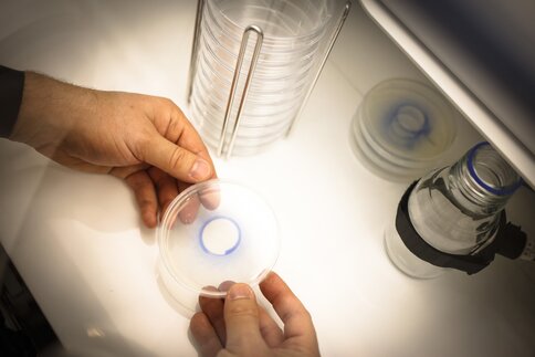 Two hands hold a Petri dish in which a finding is colored in a violet tone. There are more Petri dishes on a table next to it.
