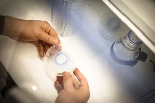 Zwei Hände halten eine Petrischale, in der ein Befund in einem Violetton eingefärbt ist. Daneben stehen auf einem Tisch weitere Petrischalen.